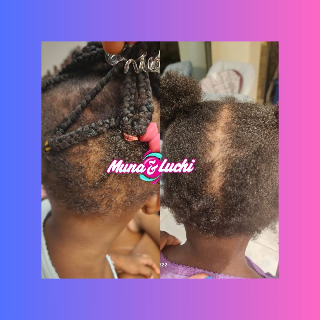 Hair growth products